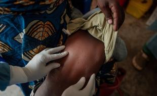 The mpox virus is spreading through parts of Africa. (Photo: World Health Organization via X.)